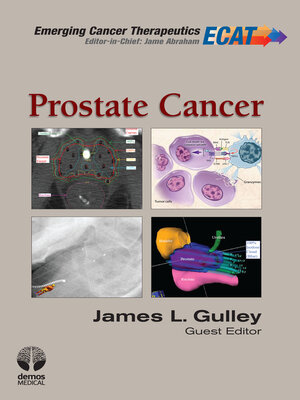 cover image of Prostate Cancer